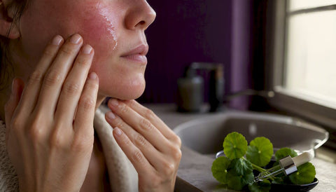 Korean Skincare for Rosacea-Prone Skin: A Calm Guide - Lunara Cosmetics