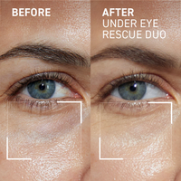 OOTD Day And Night Eye Care Duo