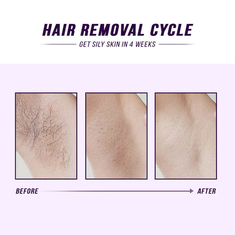 ETERUS Laser IPL Hair Removal - Lunara Shopping