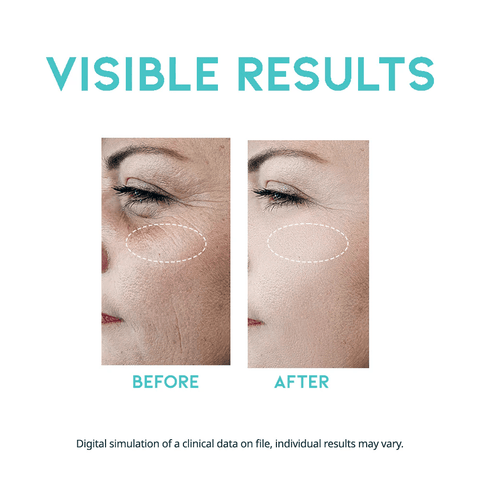OOTD Wrinkle Lift Eye Serum (1.05 fl.oz) - Lunara Shopping