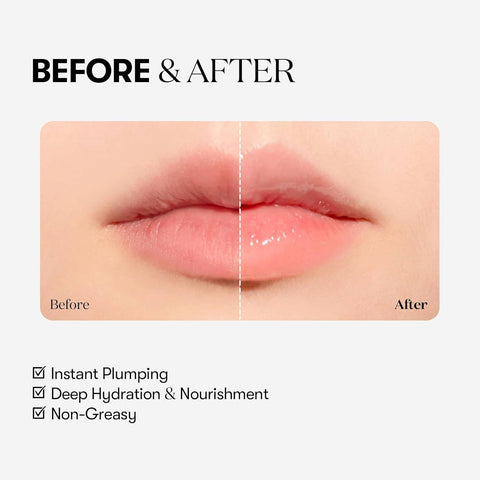 VT COSMETICS Reedle Shot Lip Plumper (0.15 fl.oz) - Lunara Shopping