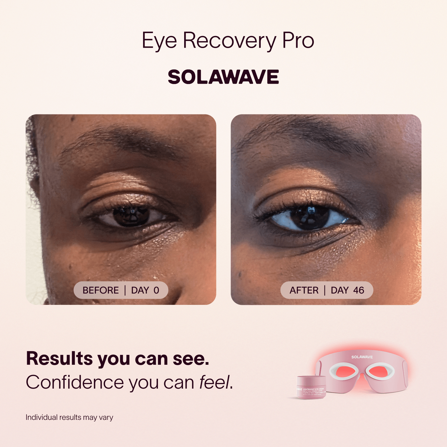 Solawave Eye Recovery Pro Kit