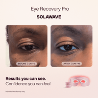Solawave Eye Recovery Pro Kit